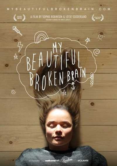 مشاهدة فيلم My Beautiful Broken Brain 2014 مترجم